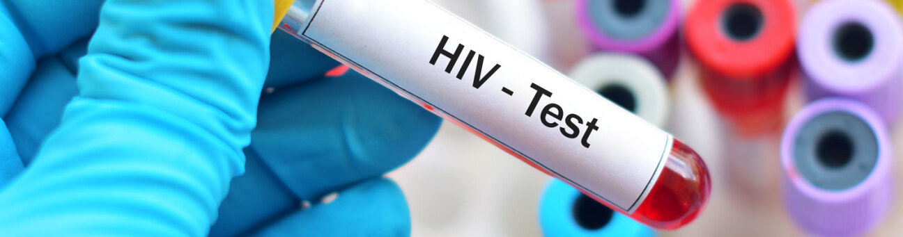 HIV-Tests