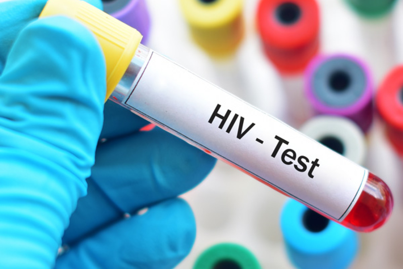 Eine Hand mit Handschuh hält ein Röhrchen mit der Aufschrift HIV-Test., Bild © jarun011 / stock.adobe.com