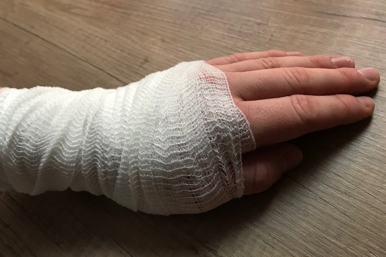 verbundene Hand, Bild © Dr. Ulrike Goeken-Haidl / Gesundheitsamt Stadt Nürnberg