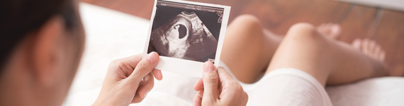 Ultraschallbild einer Schwangeren