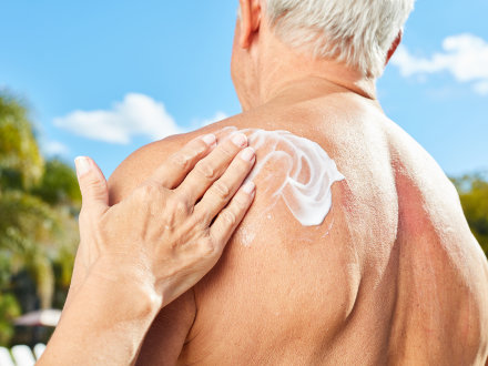 Das Bild zeigt einen älteren Mann mit Sonnen·creme auf dem Rücken.