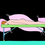 Zeichnung eines Mannes, der auf einer Massageliege liegt, während riesige Nachtschnecken über ihn ziehen