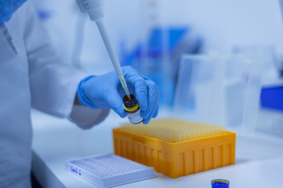 Nahaufnahme Labortätigkeit mit einer Kolbenhubpipette