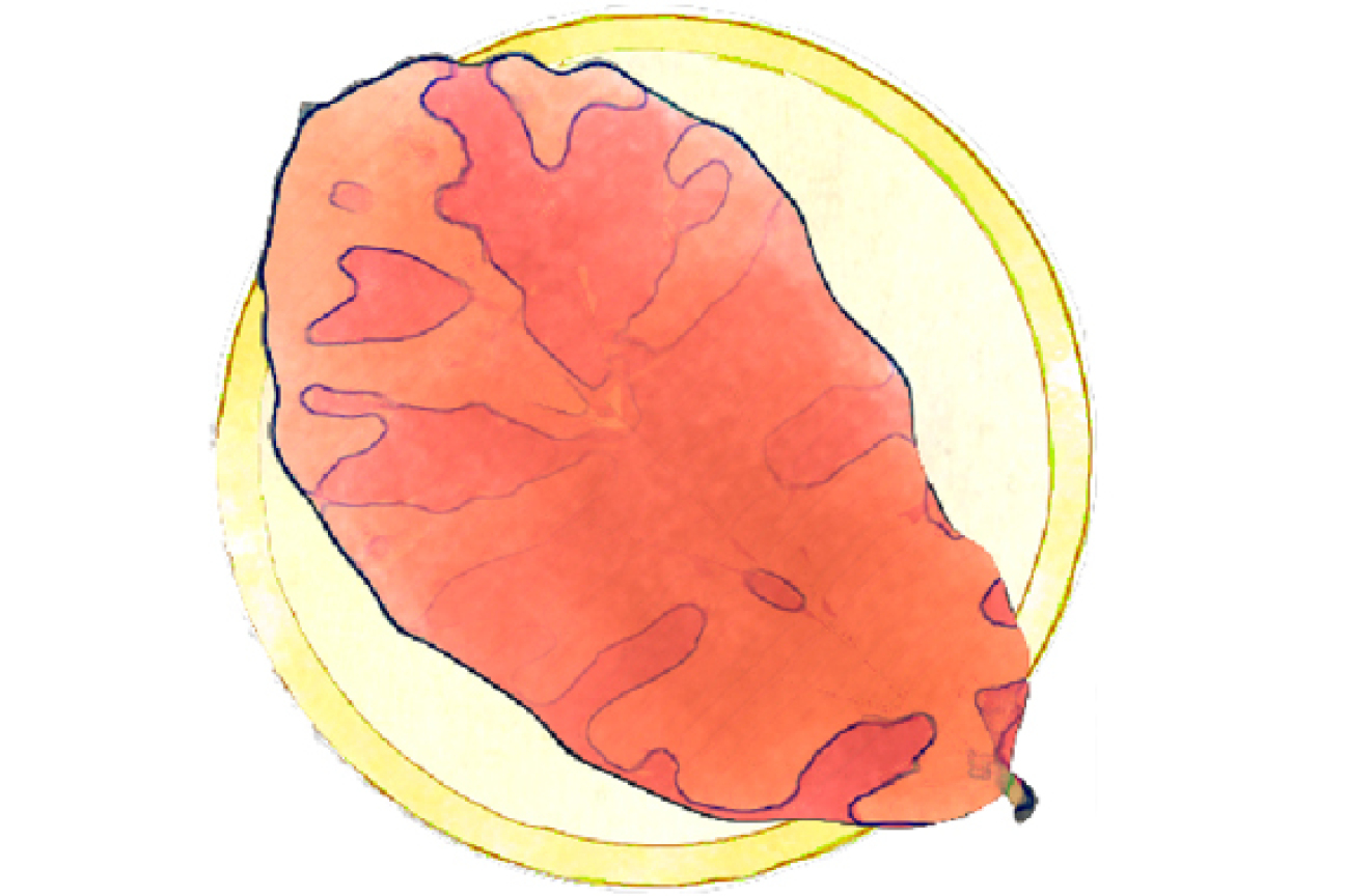 Bild © SÖR Eisenholzbaum, Bild © SÖR