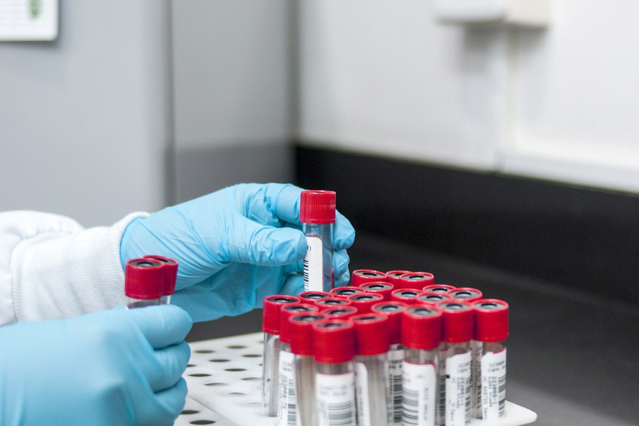 Proben in einem medizinischen Labor., Bild © pixabay